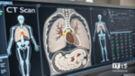 医院 CT、磁共振、X 光收费将执行新规：手机不能看 CT 图像就要少收费